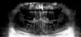 forensic odontology